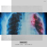 Uniform EP