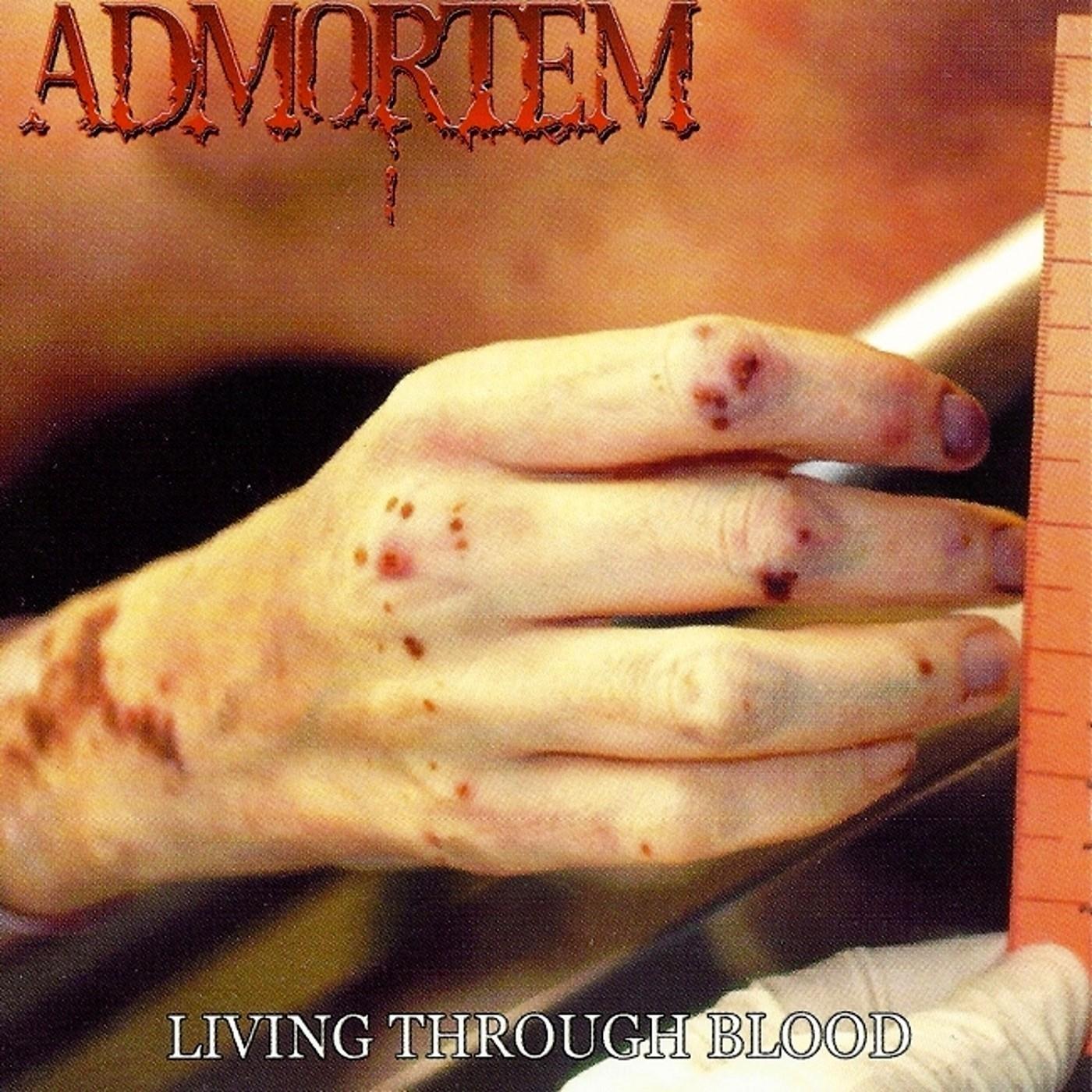 Severly Mentally Retarded