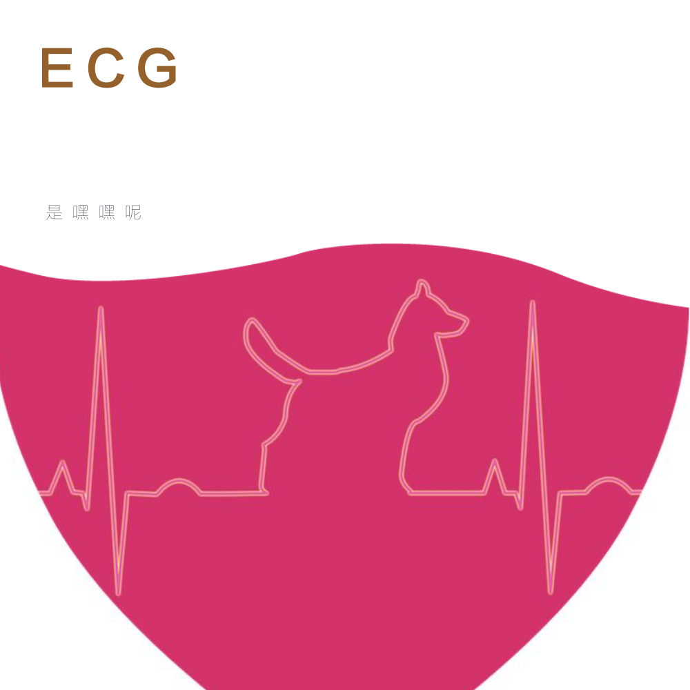 ECG