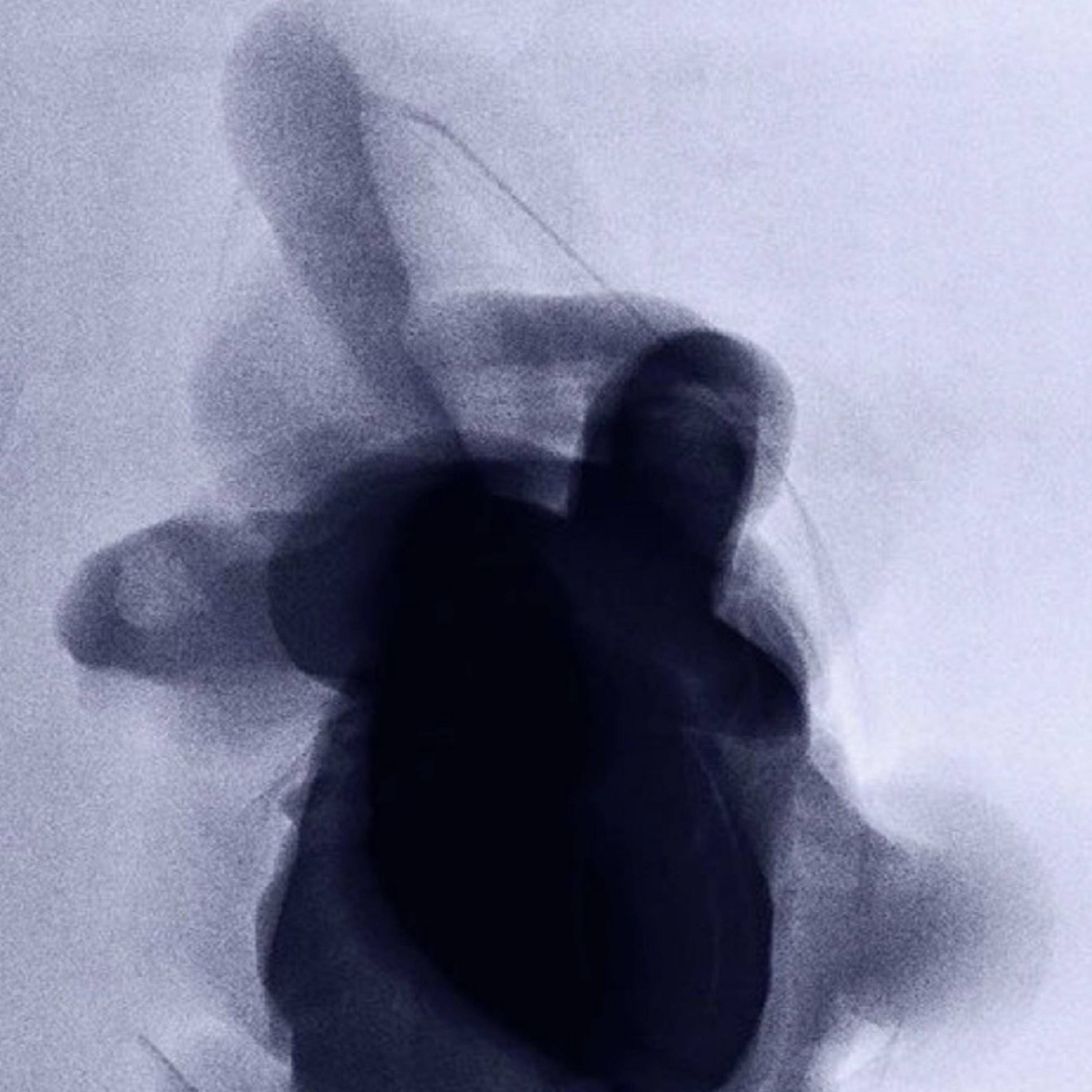 Vinyl / Side A (feat. Wakai & SMV)