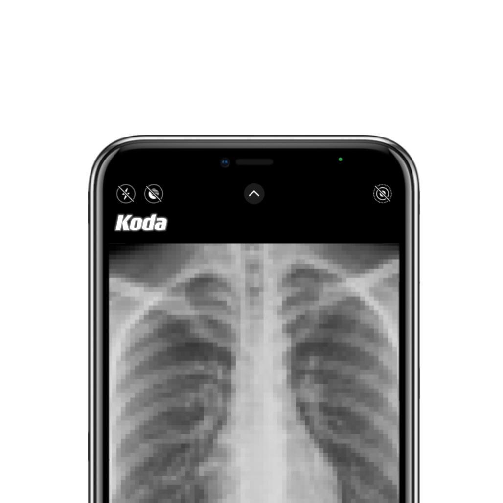 X-ray(Prod.sleepy & RoyalBoyBrazy)