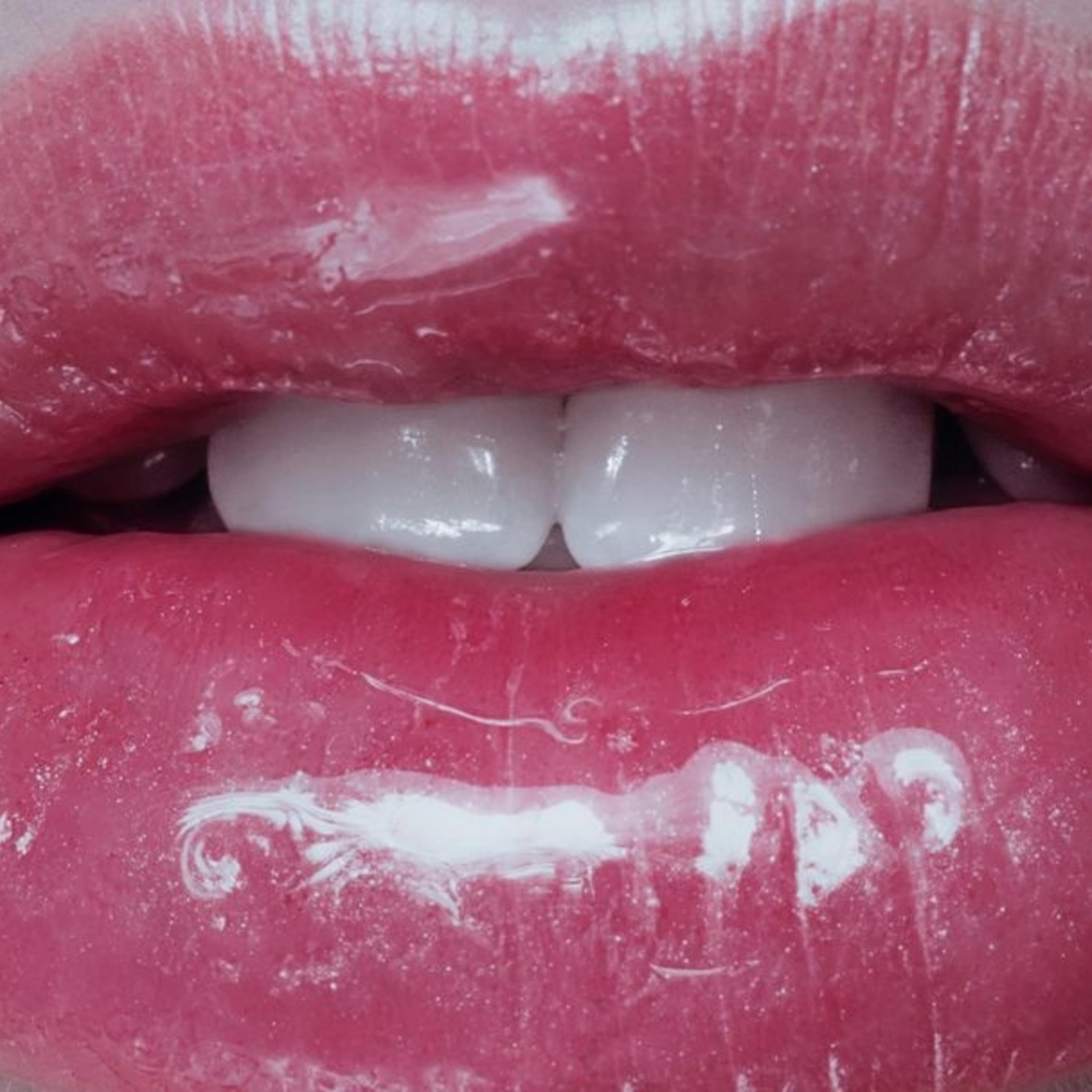 ALL PINK (feat. Kid Trash & Lil Yawh)