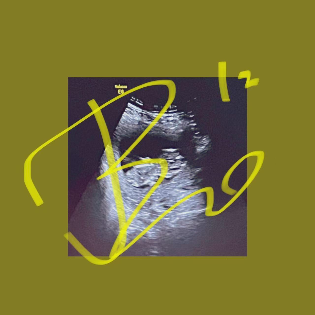 白_暗店街乐队_白 | 在线播放_白歌词_白下载 | 网易云音乐