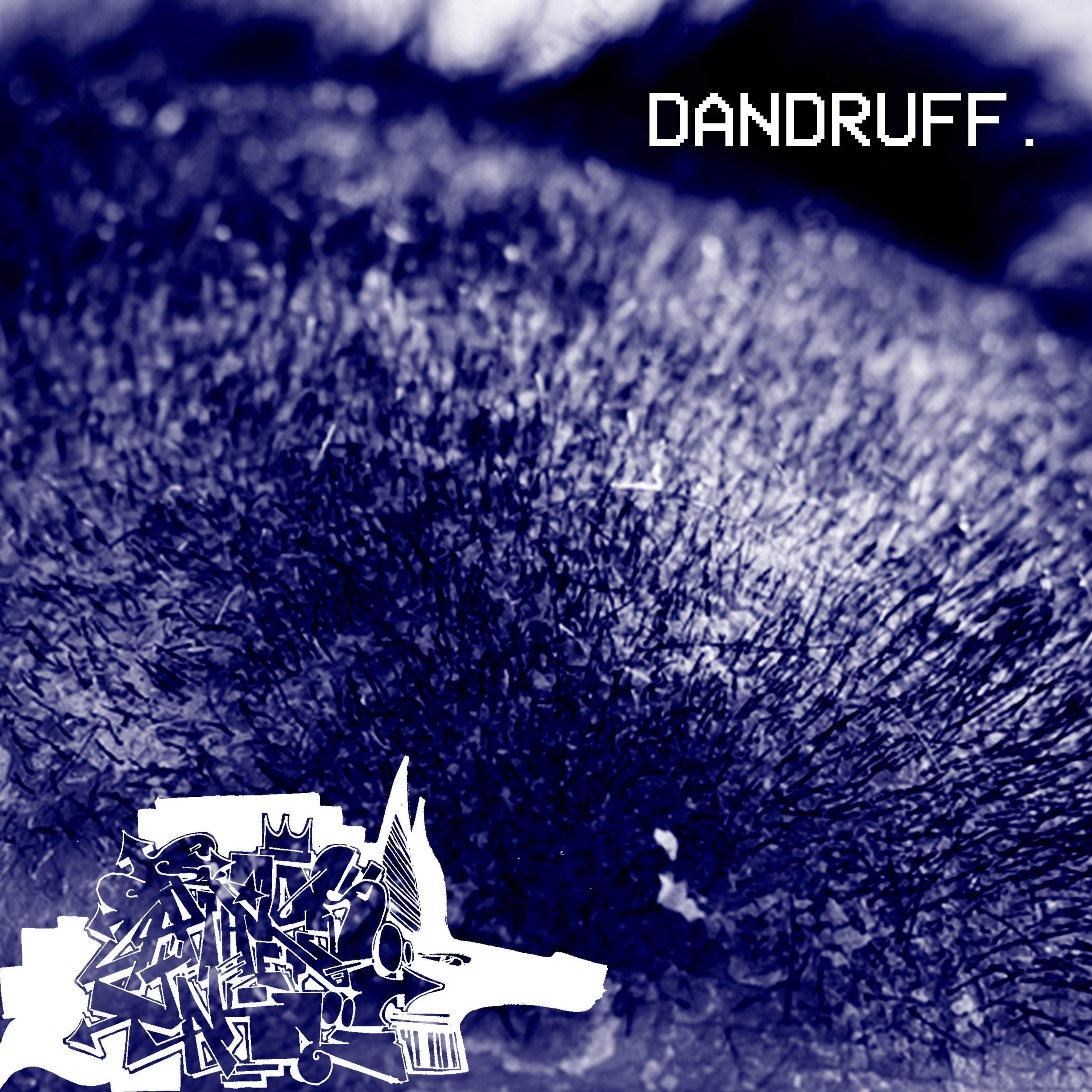 Dandruff