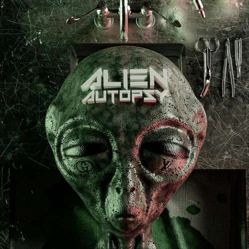 alien autopsy