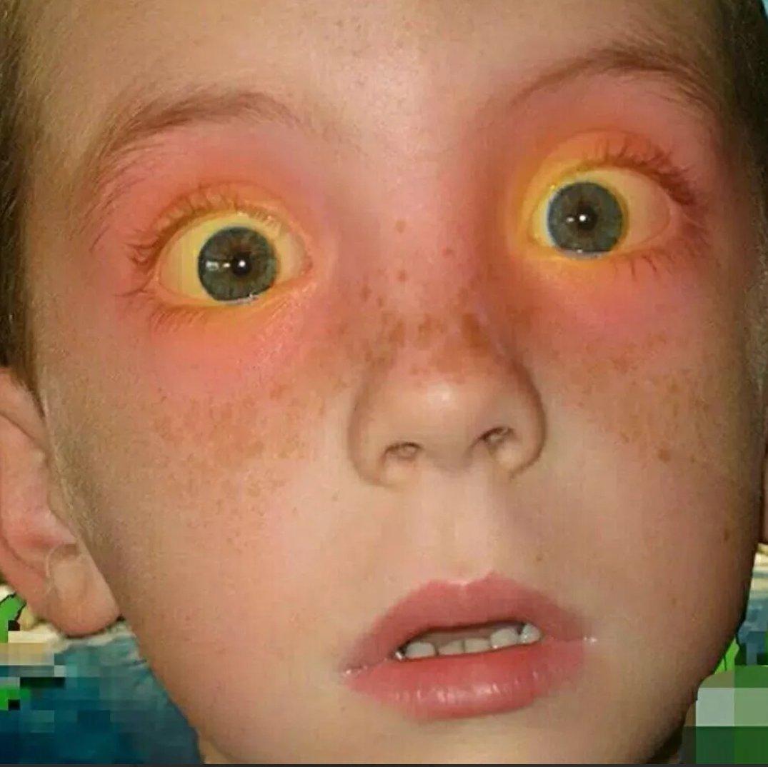 猜你喜欢林左嘉