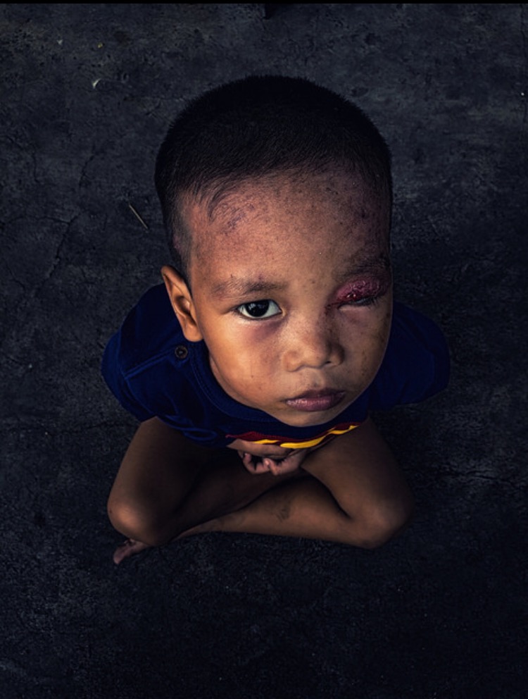 幼稚园杀手丨封面来源