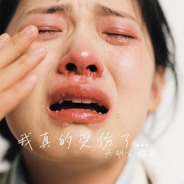 我真的受伤了(R&B版)（Cover DinDin） - 后来的你封面