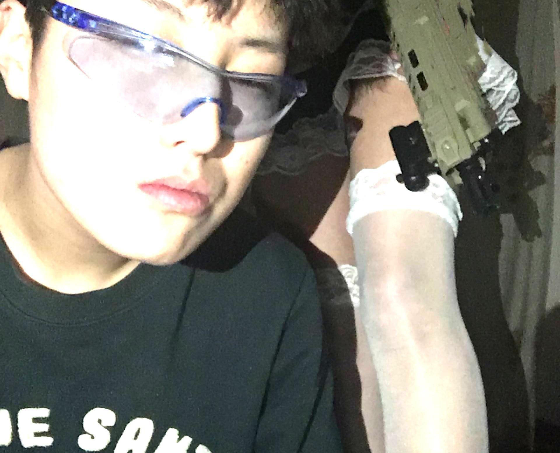 -艾兜