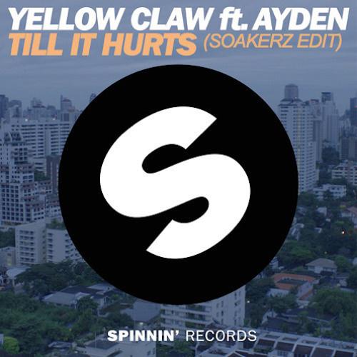 Till It Hurts (Soakerz Festival Big Room Edit)专辑