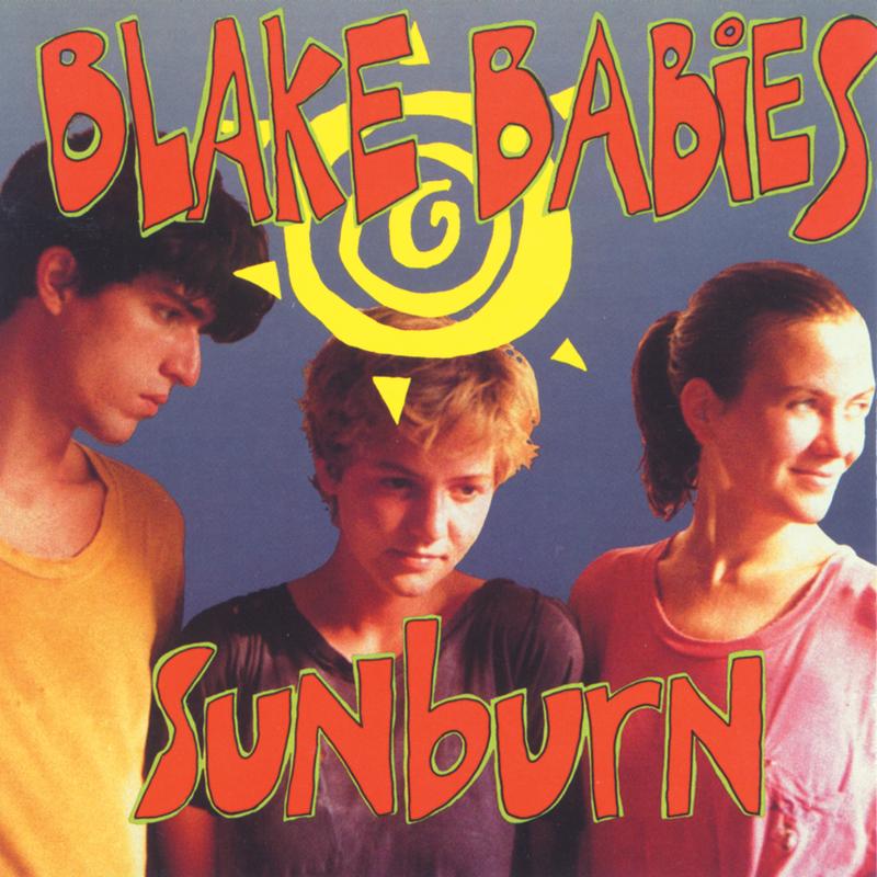 Sunburn