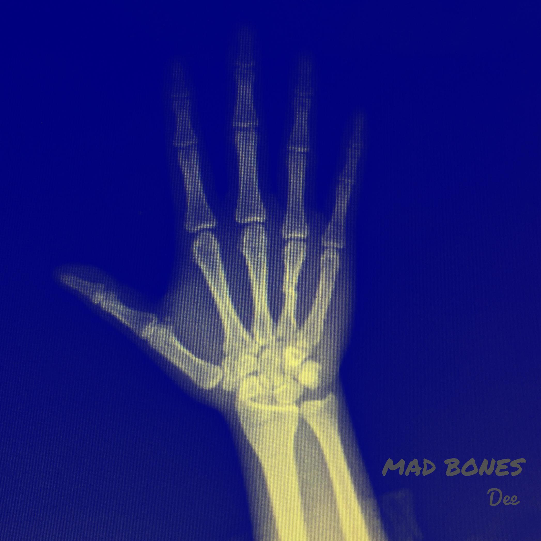 Mad Bones