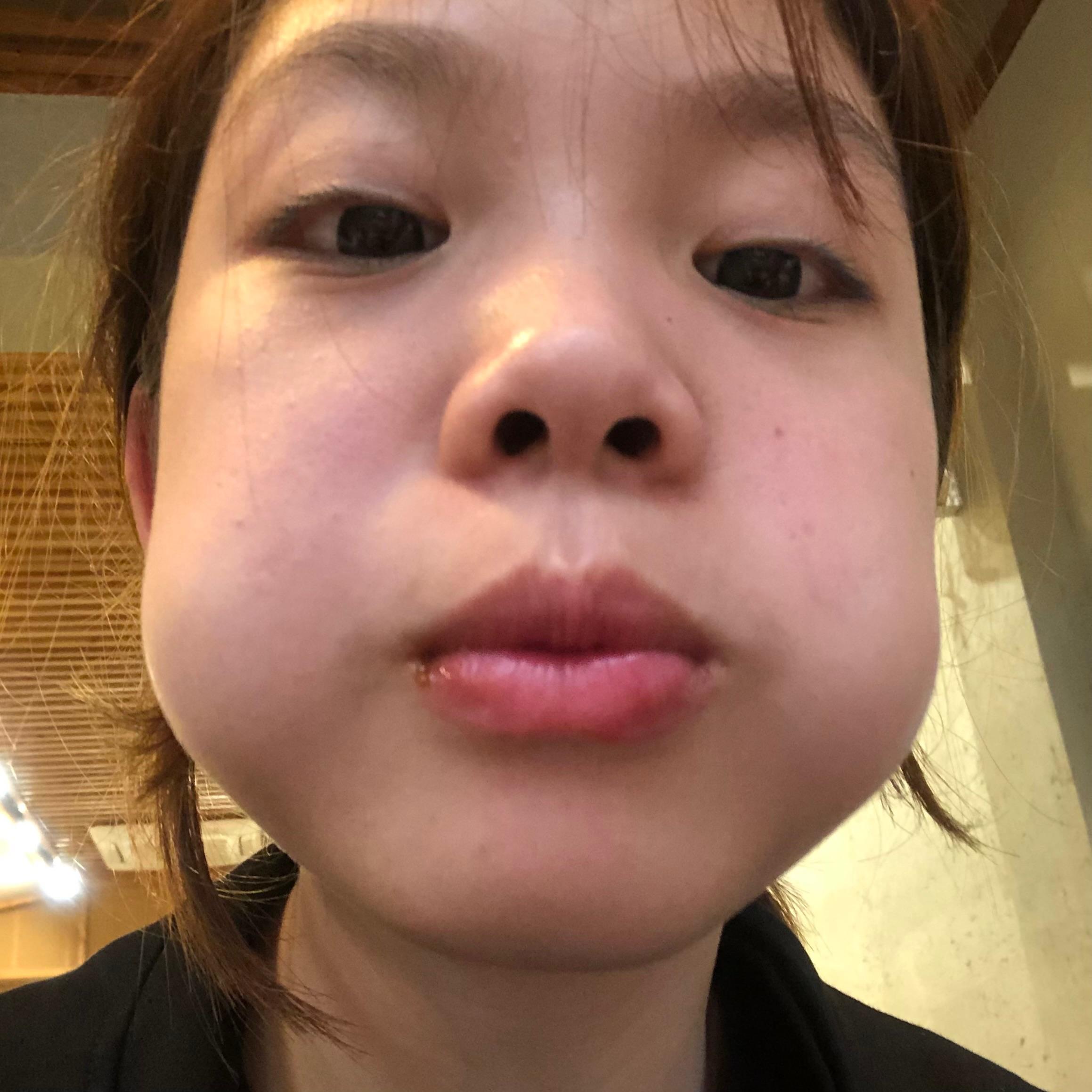 豆豆