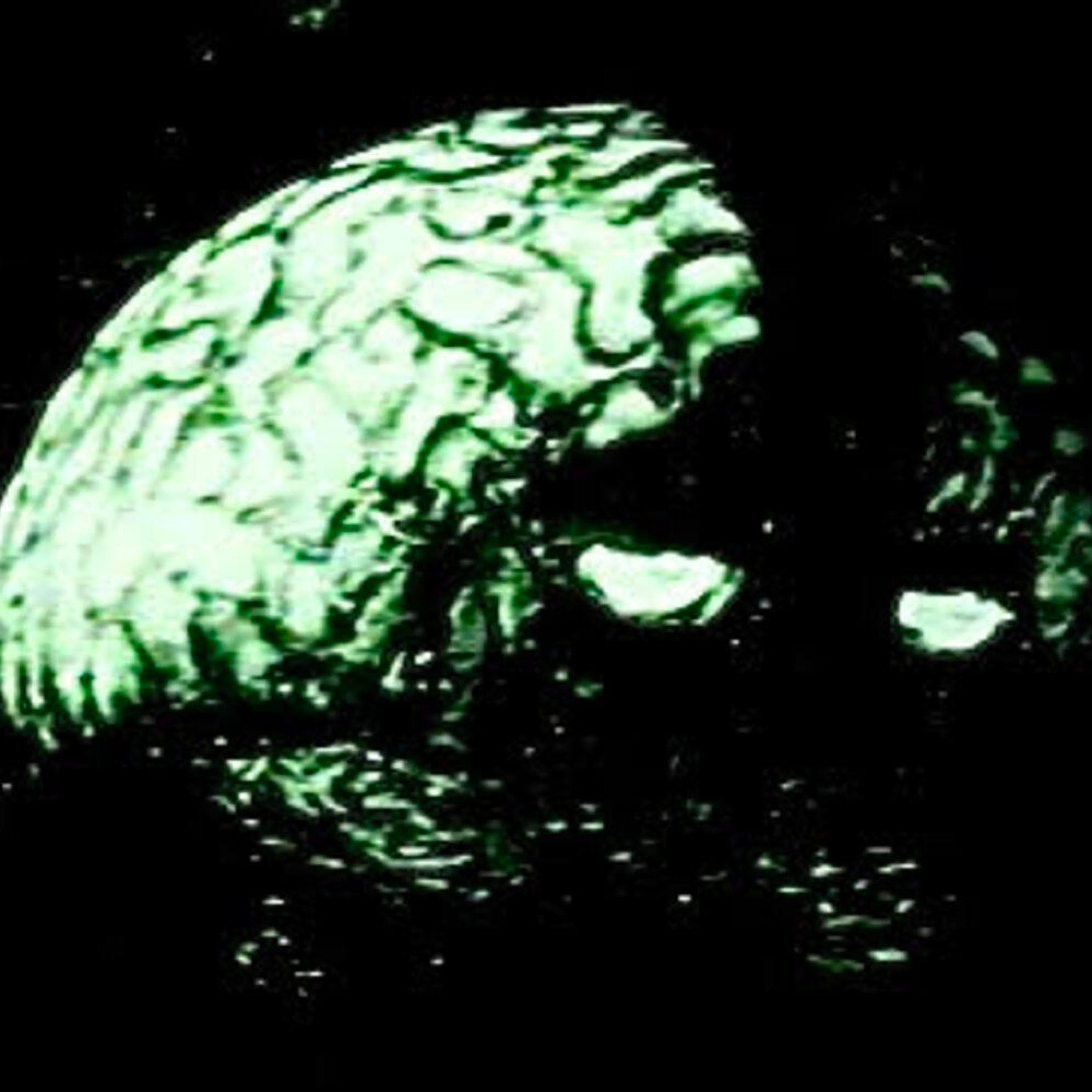 PARASITICBRAIN****!
