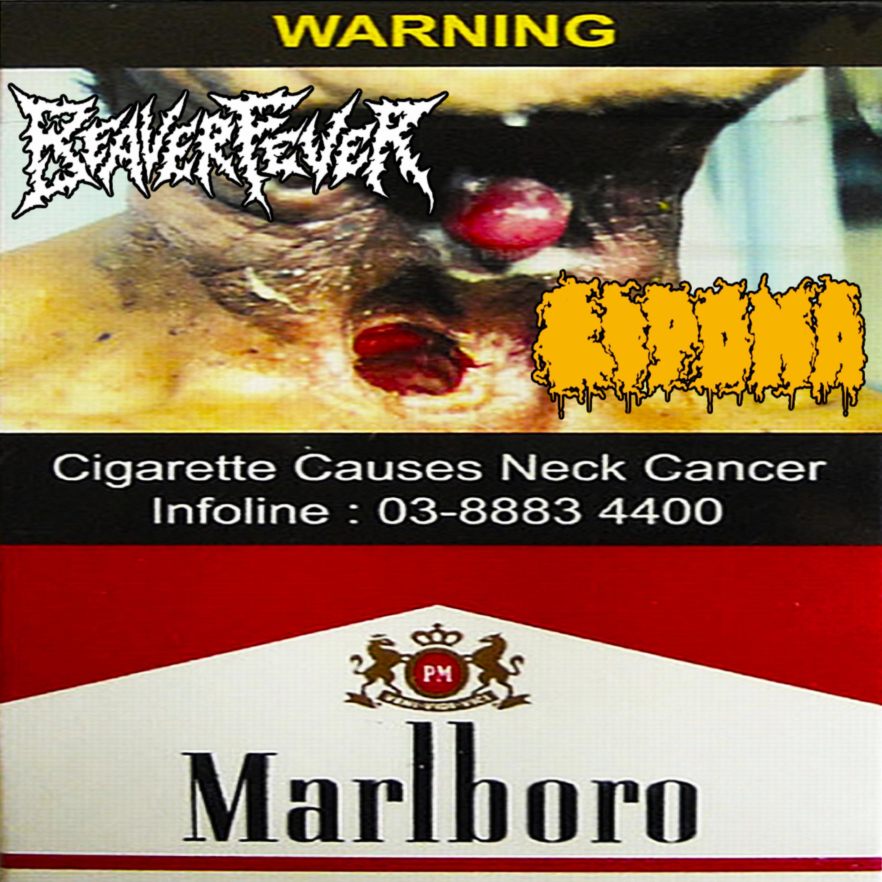 Deep Vein Thrombosis