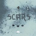 Scars