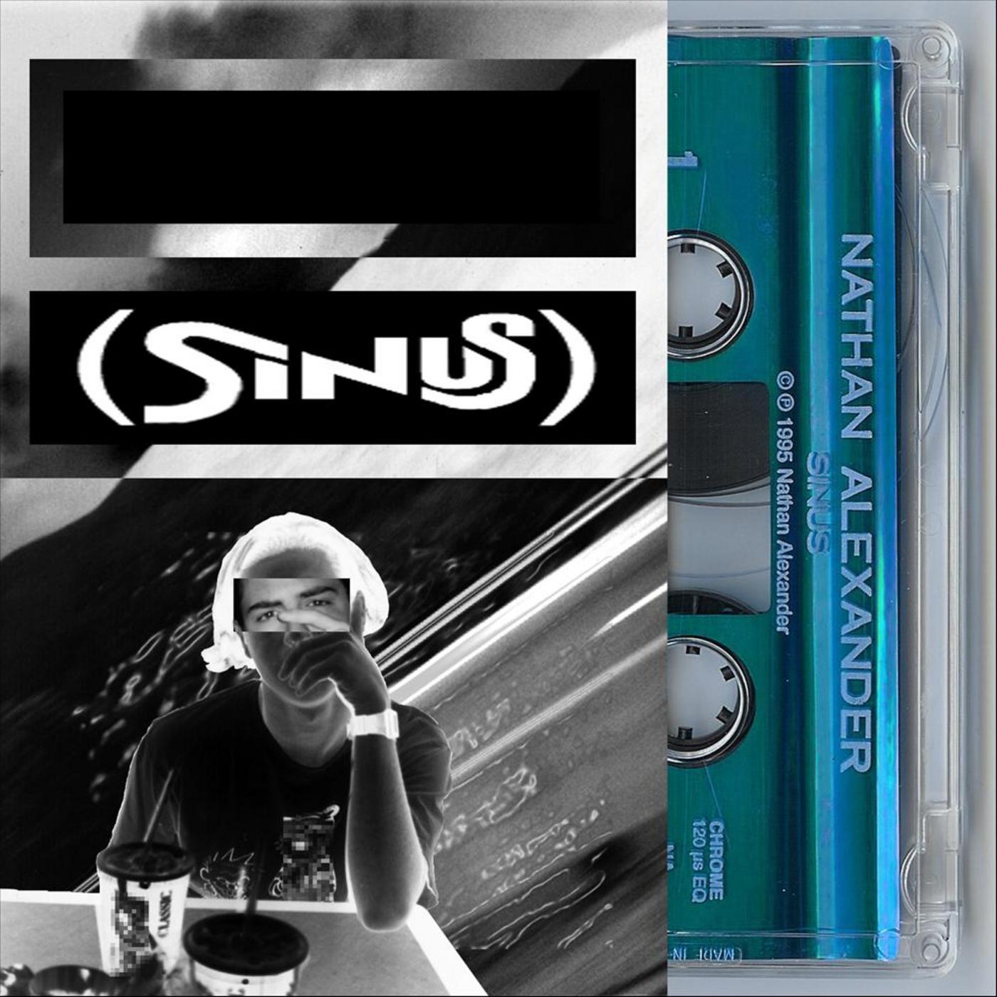 Sinus