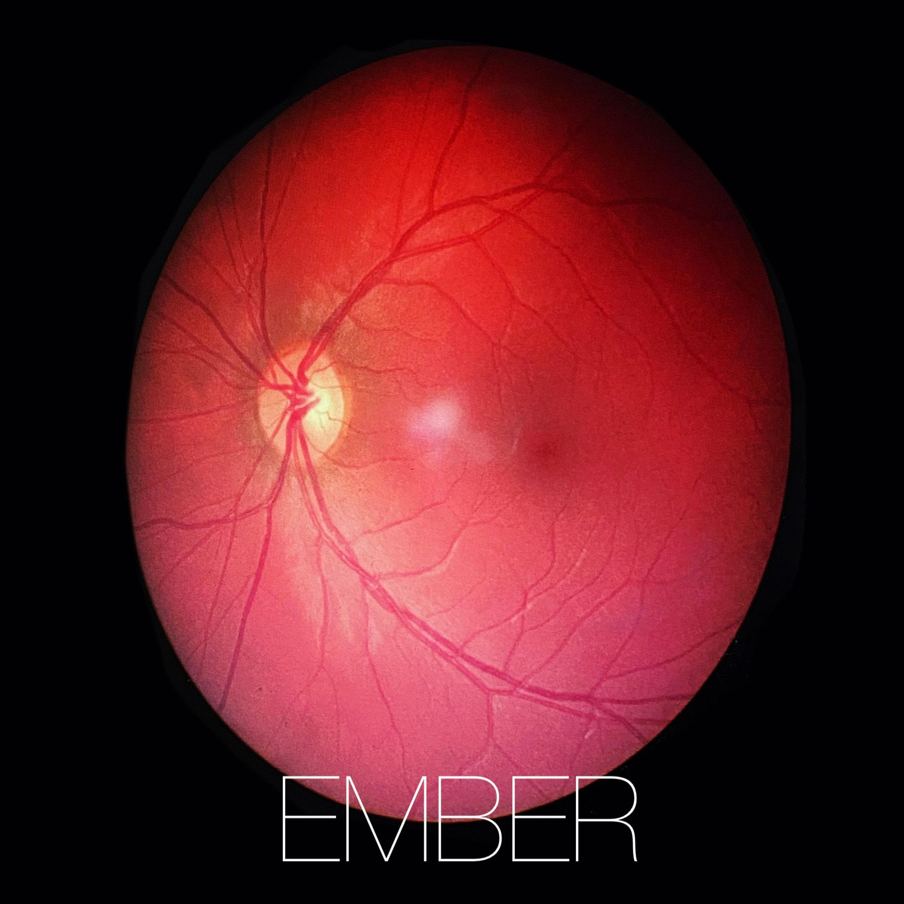 Ember