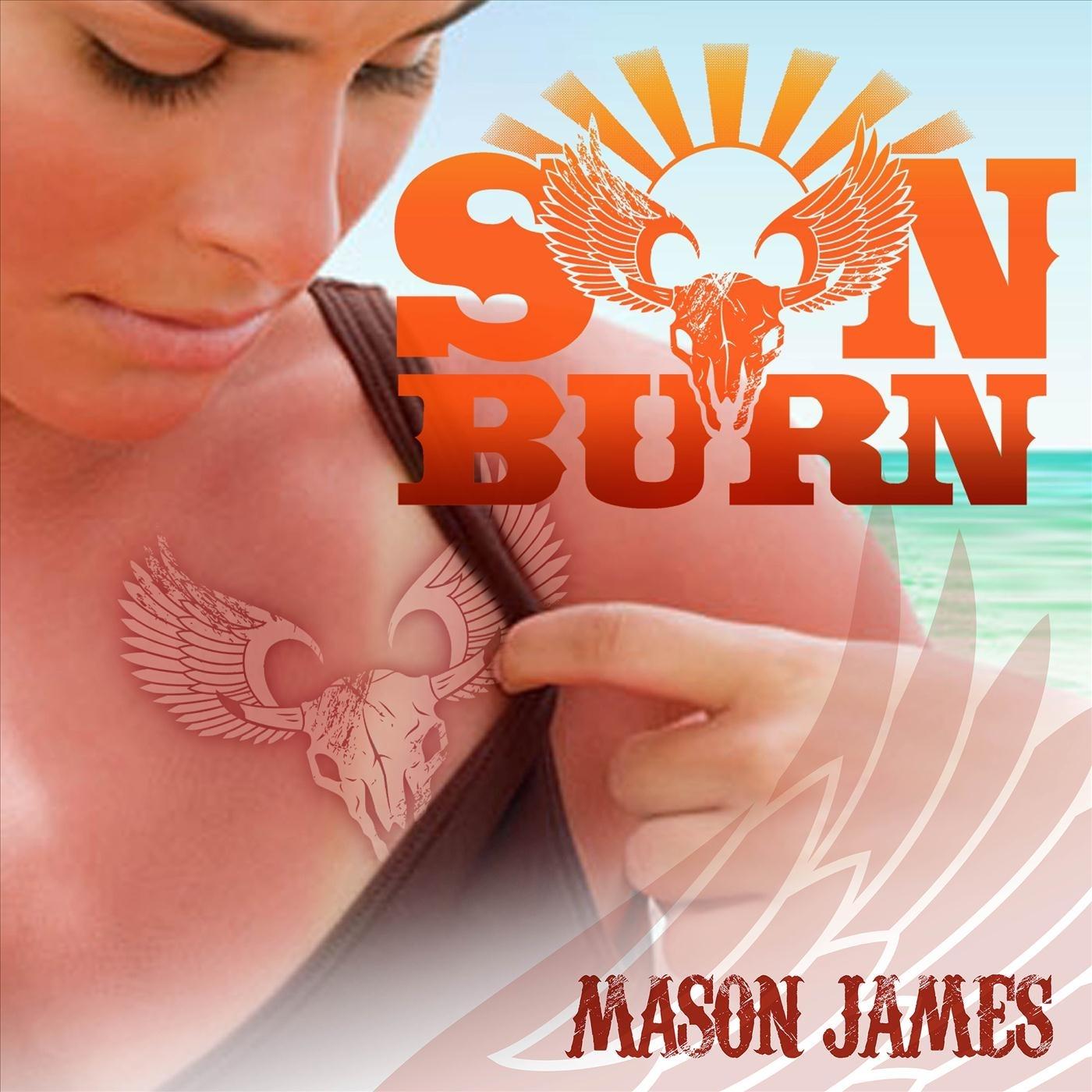 Sunburn