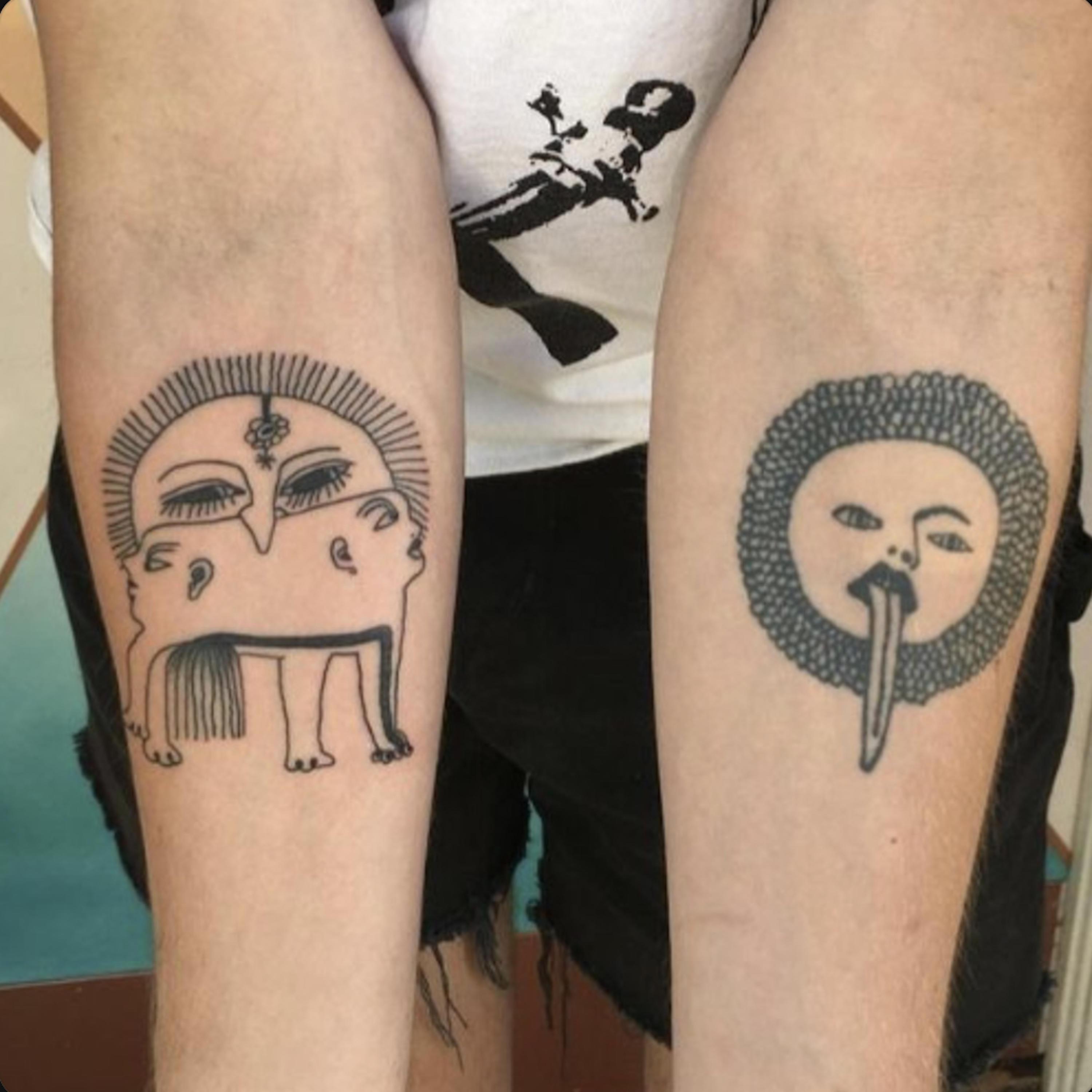 no ring on it (sur6ery)