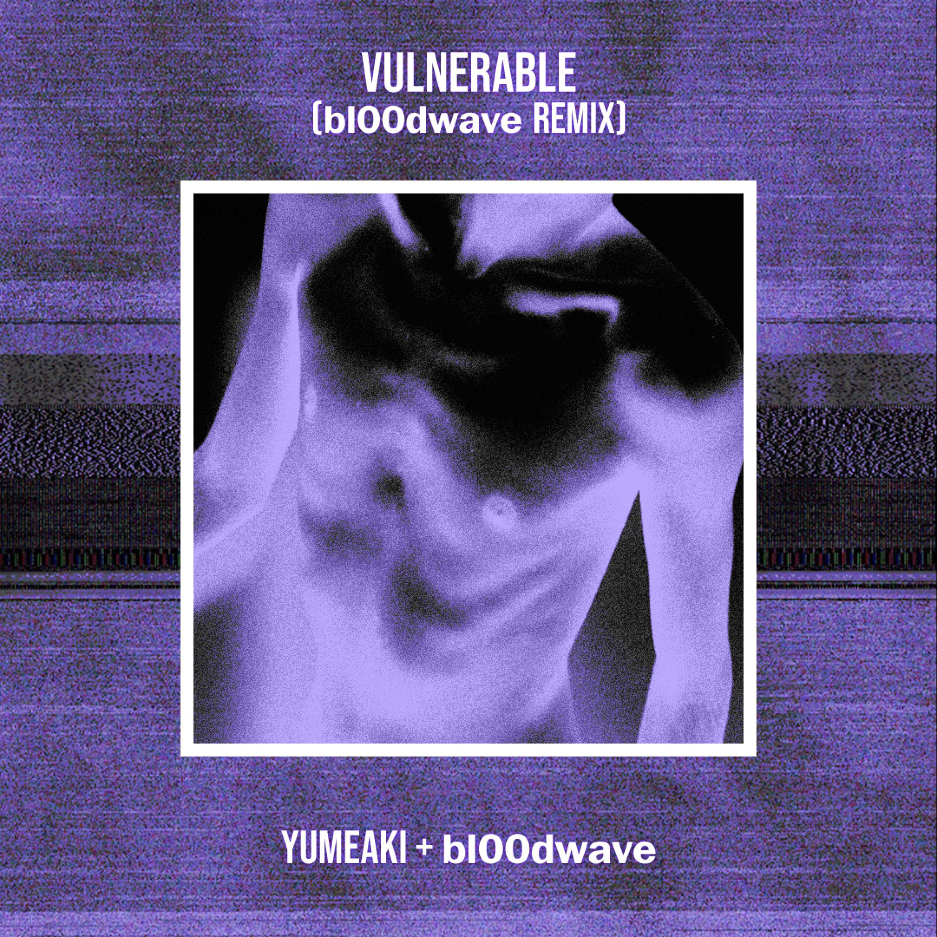 Vulnerable