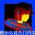 横から見た口内炎 (feat. 初音ミク)