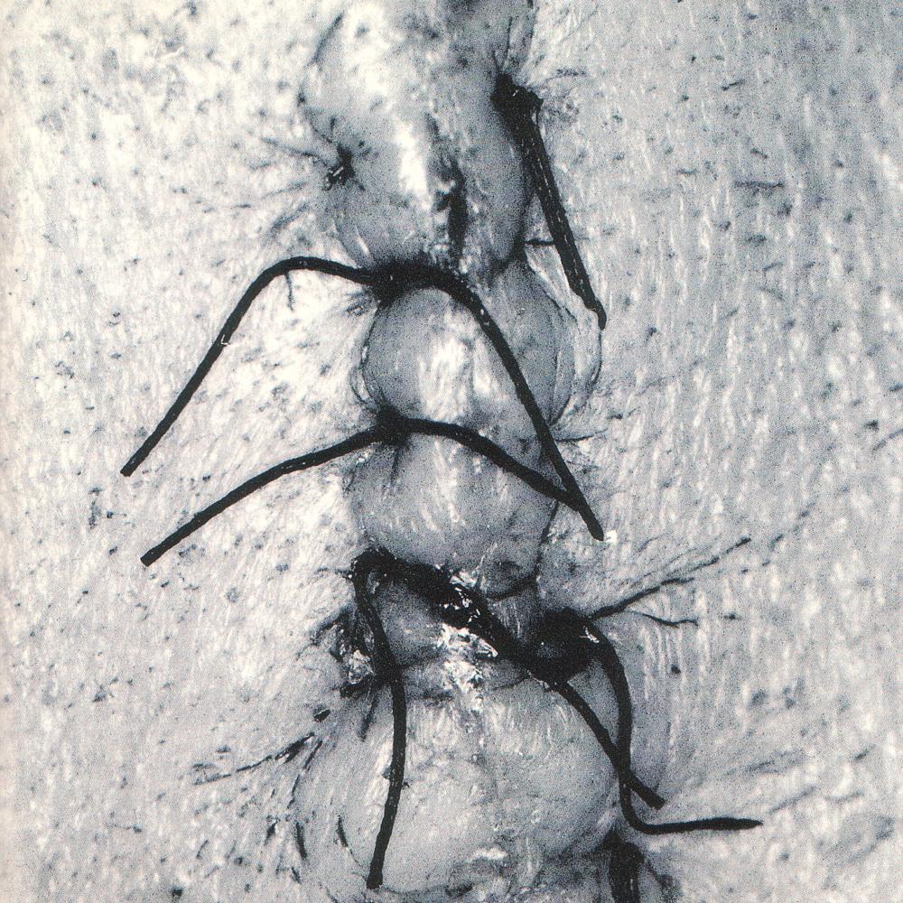Infliction