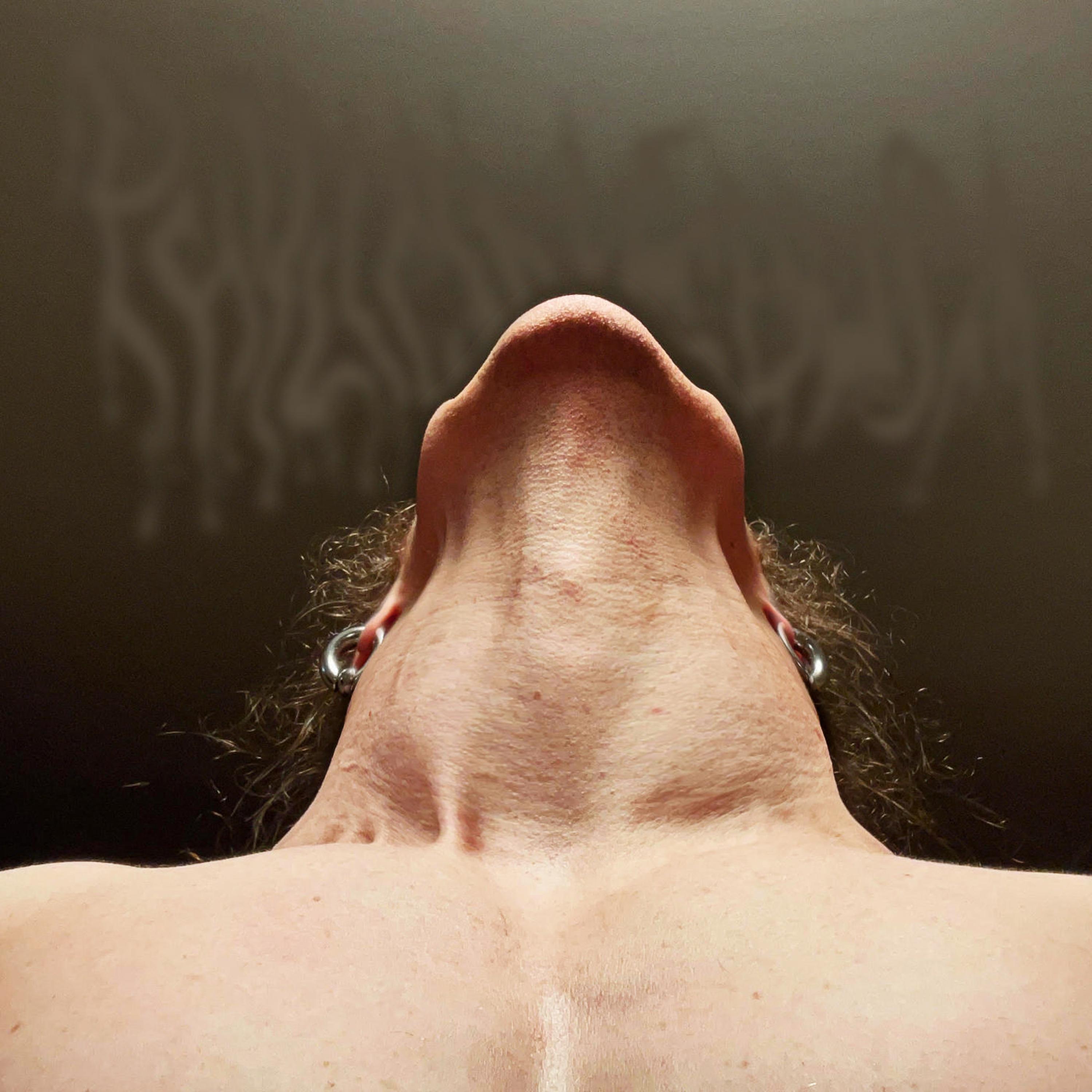 Augmentation Of A Neck