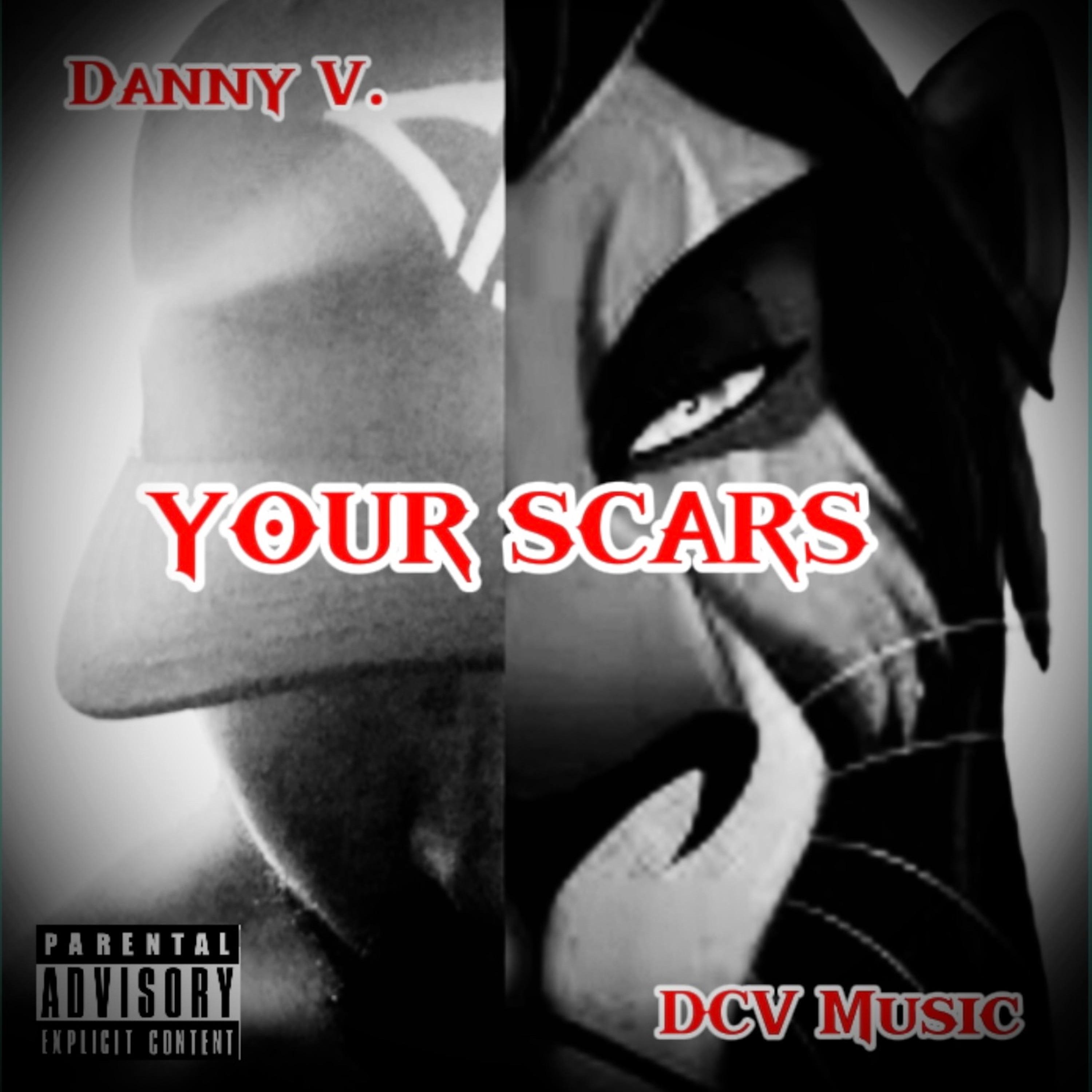 Your Scars
