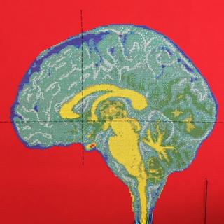 ☁︎ 腦 部 失 重