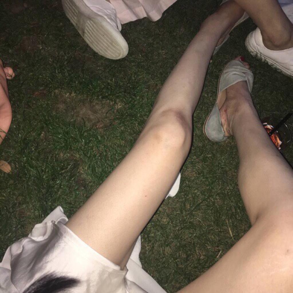 你眼中湿度七十九的空气