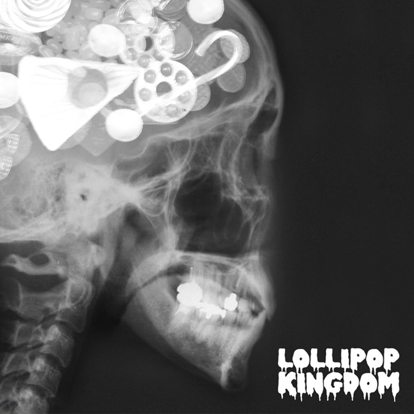 Lollipop Kingdom <Standard Edition>
