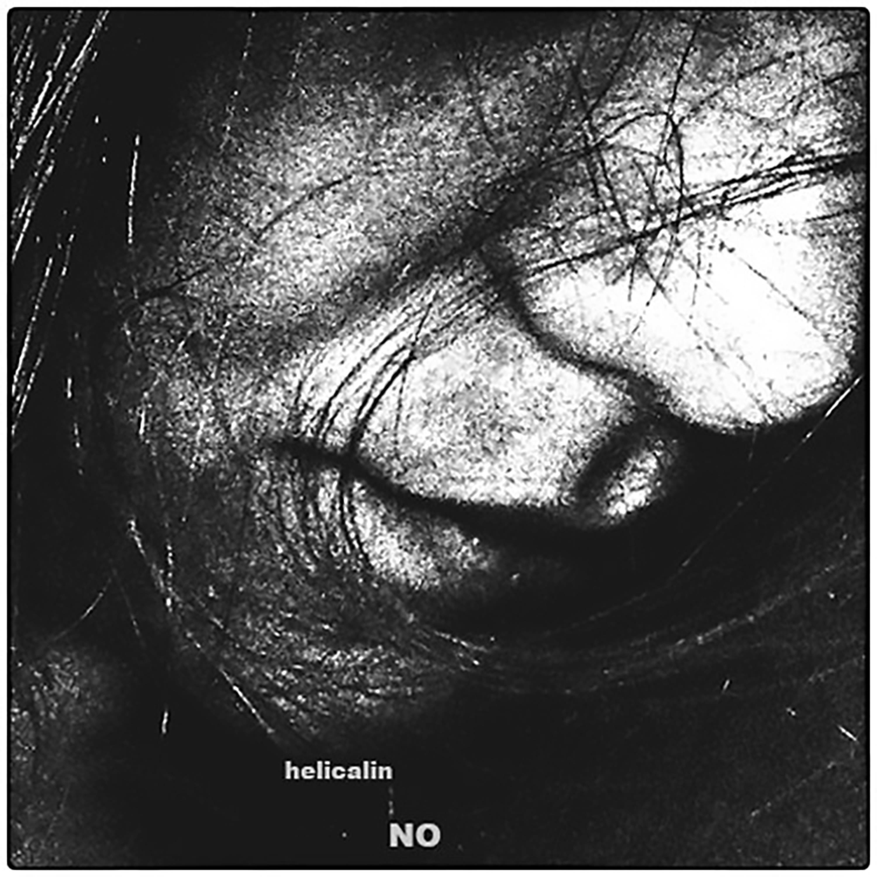 NO