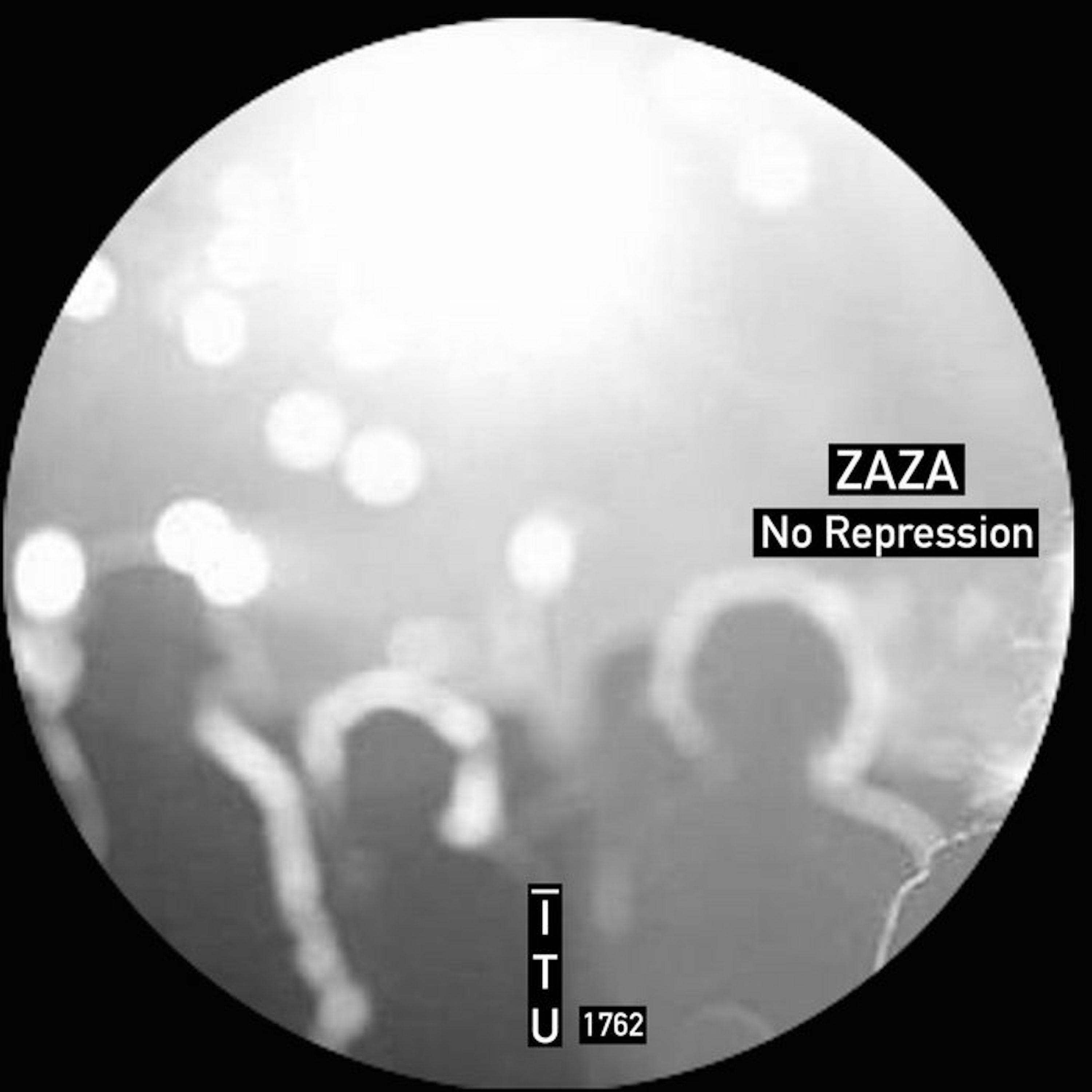 No Repression