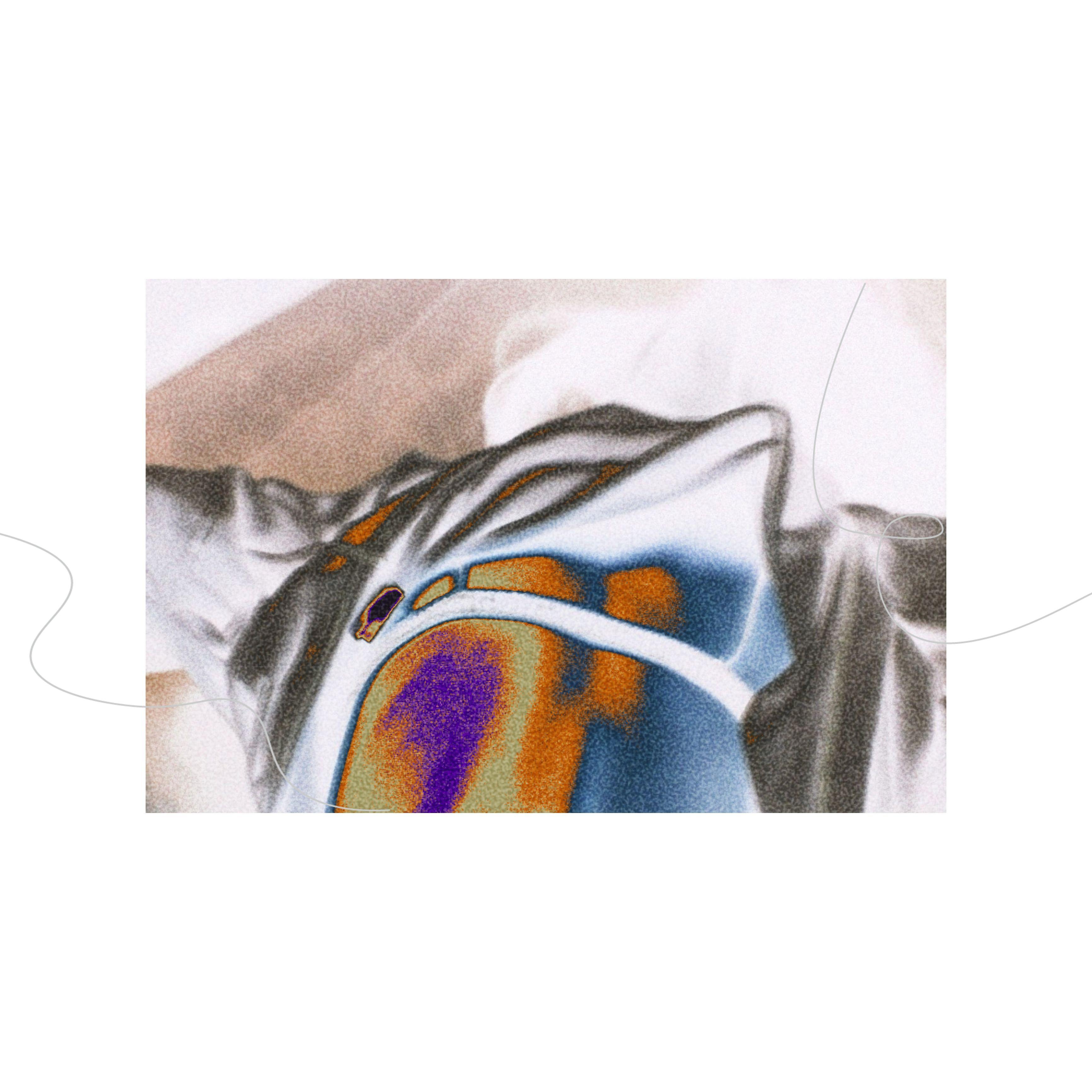 asphyxia