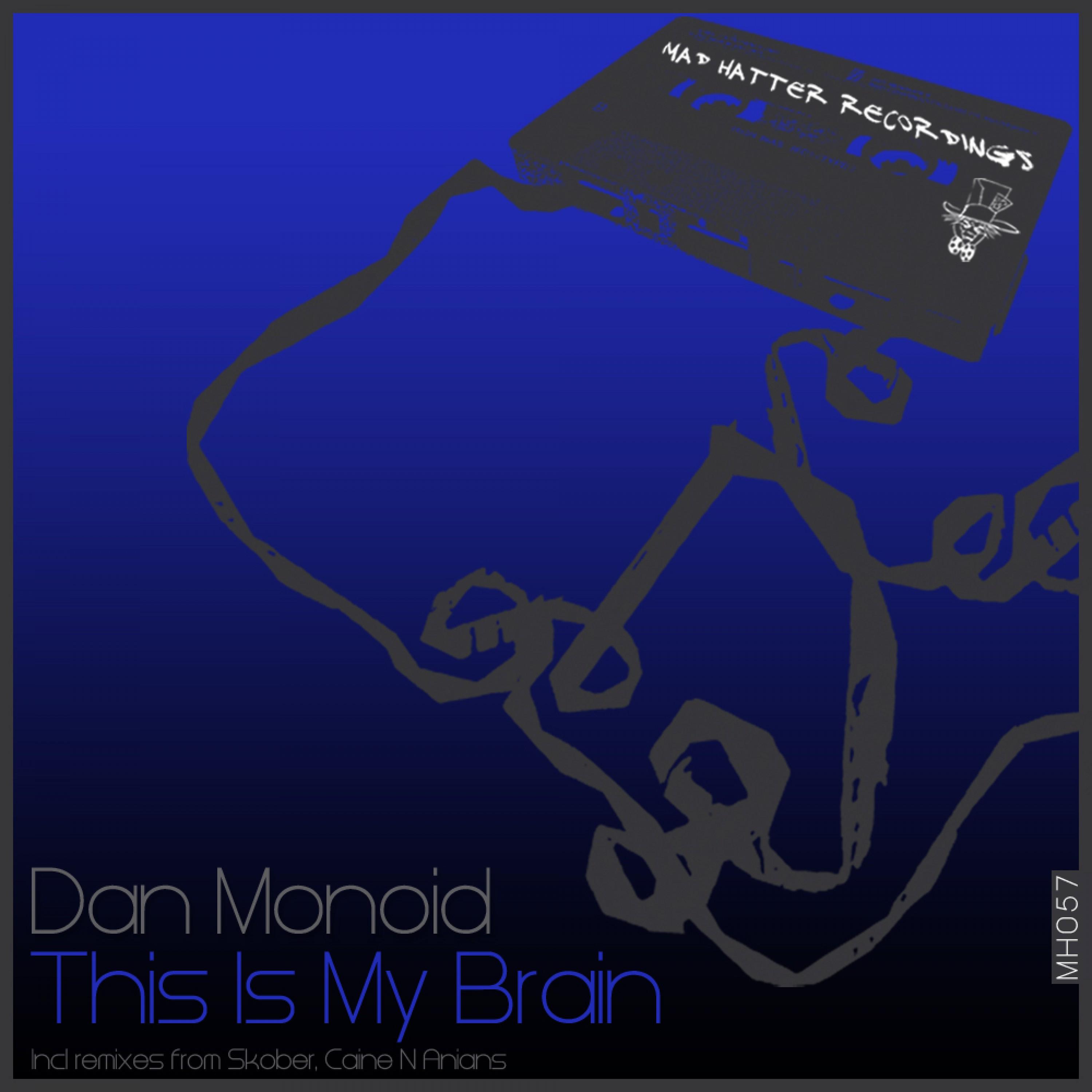 This Is My Brain