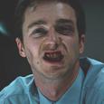 Broken Teeth