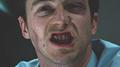 Broken Teeth专辑