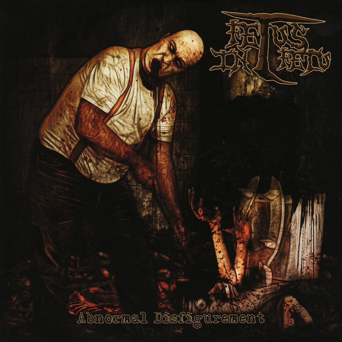Abnormal Disfigurement